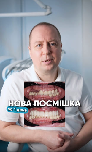 Ukrstom center